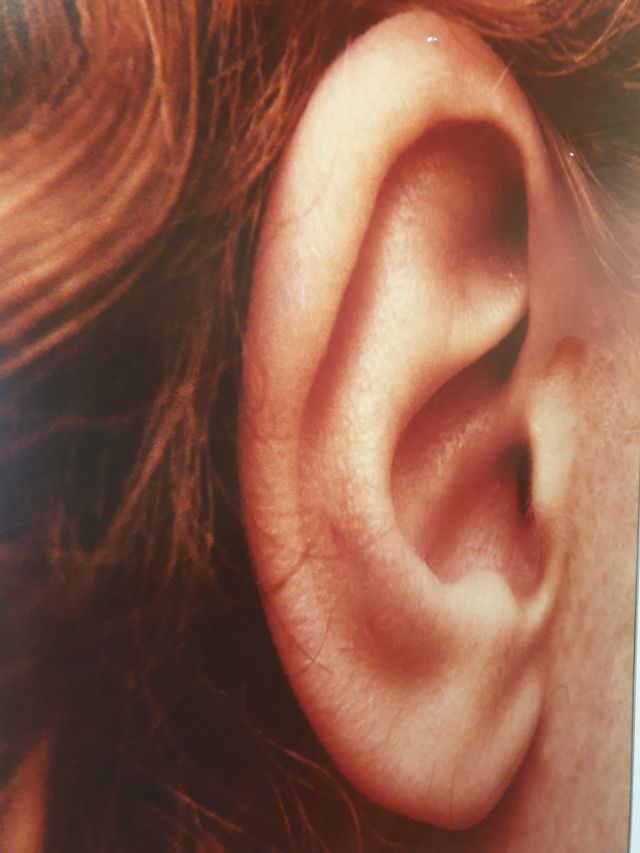Ein menschliches Ohr ist von nahe zu sehen.